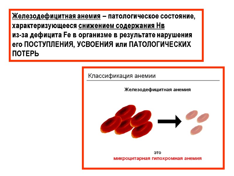 Железодефицитная анемия – патологическое состояние, характеризующееся снижением содержания Нв  из-за дефицита Fe в